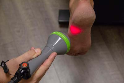 Neuropathy Laser