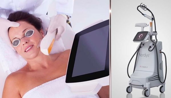 Tratamiento Laser Nordlys®